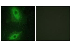 Immunofluorescence analysis of HeLa cells, using TNFSF15 antibody. (TNFSF15 抗体  (C-Term))