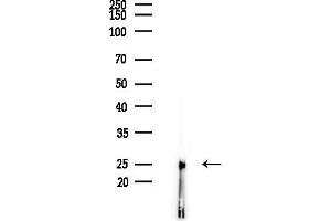 Western blot analysis of lysates from COLO205 cells(heat-shock,45 min treatment), using NDUFV2 Antibody at 1/1000 dilution.
