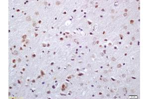 Formalin-fixed and paraffin embedded rat brain labeled with Anti-Phosphoserine/threonine Polyclonal Antibody, Unconjugated (ABIN1385068) at 1:200 followed by conjugation to the secondary antibody and DAB staining (Phosphoserine/Threonine (phosphorylated) 抗体)