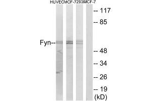 Western blot analysis of extracts from HUVEC cells, MCF-7 cells and 293 cells, using Fyn (epitope around residue 530) antibody. (FYN 抗体  (Tyr530))