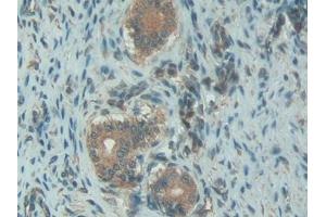 Detection of C1INH in Rat Uterus Tissue using Polyclonal Antibody to Complement 1 Inhibitor (C1INH) (SERPING1 抗体  (AA 148-270))