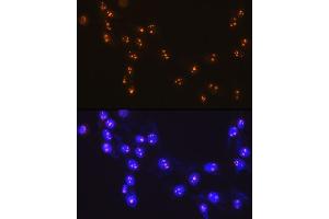 Immunofluorescence (IF) image for anti-Fibrillarin (FBL) antibody (ABIN7267175)
