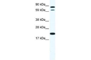 Western Blot showing ZFP287 antibody used at a concentration of 1-2 ug/ml to detect its target protein. (ZNF287 抗体  (N-Term))