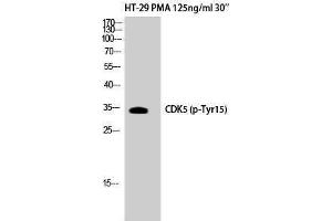 Western Blotting (WB) image for anti-Cyclin-Dependent Kinase 5 (CDK5) (pTyr15) antibody (ABIN3179551) (CDK5 抗体  (pTyr15))