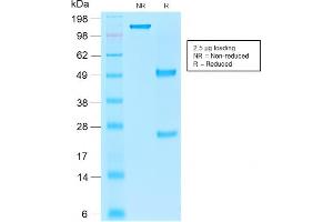 SDS-PAGE (SDS) image for anti-Epithelial Cell Adhesion Molecule (EPCAM) (AA 280-350), (Cytoplasmic Domain) antibody (ABIN6939986)