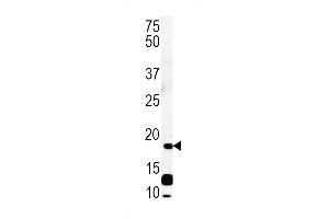 RCL Antibody (N-term) (ABIN652111 and ABIN2840553) western blot analysis in CEM cell line lysates (35 μg/lane).