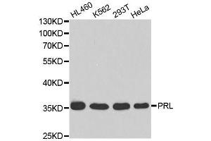 Western blot analysis of extracts of various cell lines, using PRL antibody. (Prolactin 抗体  (AA 29-227))