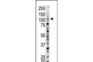 Antibody is used in Western blot to detect USP15 in mouse brain tissue lysate. (USP15 抗体  (N-Term))