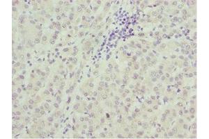 Immunohistochemistry (IHC) image for anti-TAF5 RNA Polymerase II, TATA Box Binding Protein (TBP)-Associated Factor, 100kDa (TAF5) (AA 656-800) antibody (ABIN7172689)