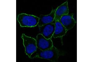Immunofluorescent analysis of MCF-7 cells, using Integrin alpha 5 Antibody.