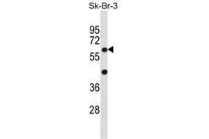 STXBP3 Antibody (Center) western blot analysis in SK-BR-3 cell line lysates (35µg/lane). (STXBP3 抗体  (Middle Region))
