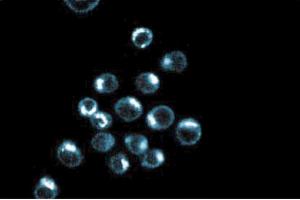 Immunoflouresence staining of HeLa cells. (p230 Trans Golgi (AA 2063-2179) 抗体)