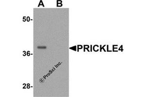 Western Blotting (WB) image for anti-Prickle Homolog 4 (PRICKLE4) (N-Term) antibody (ABIN1077371) (PRICKLE4 抗体  (N-Term))