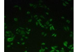 Detection of CYP1A2 in Hela cells using Polyclonal Antibody to Cytochrome P450 1A2 (CYP1A2) (CYP1A2 抗体  (AA 192-444))
