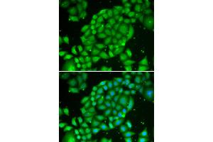 Immunofluorescence analysis of U2OS cells using TCL1A antibody (ABIN5970229). (TCL1A 抗体)