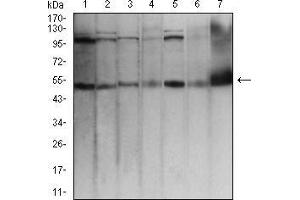 Western blot analysis using TFAP2A mouse mAb against Hela (1), MCF-7 (2), Cos7 (3), A431 (4), HCT116 (5), NIH/3T3 (6), and PC12 (7) cell lysate.