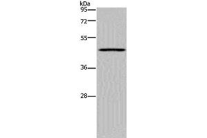 Western Blot analysis of Mouse lung tissue using MECP2 Polyclonal Antibody at dilution of 1:300 (MECP2 抗体)