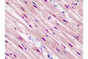 Human Heart: Formalin-Fixed, Paraffin-Embedded (FFPE) (GATA3 抗体  (N-Term))