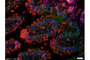 Formalin-fixed and paraffin-embedded mouse intestine labeled with Anti-GM-CSFR alpha/CD116/CSF2RA Polyclonal Antibody, Unconjugated (ABIN686812) 1:200, overnight at 4°C, The secondary antibody was Goat Anti-Rabbit IgG, Cy3 conjugated used at 1:200 dilution for 40 minutes at 37°C.