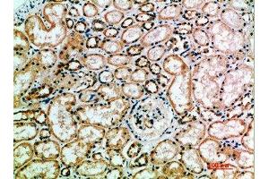 Immunohistochemistry (IHC) image for anti-Killer Cell Immunoglobulin-Like Receptor, three Domains, Long Cytoplasmic Tail, 2 (KIR3DL2) (AA 221-270) antibody (ABIN7189471)