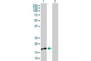 Western Blot analysis of FGF1 expression in transfected 293T cell line by FGF1 MaxPab polyclonal antibody. (FGF1 抗体  (AA 1-155))