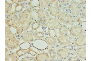 Immunohistochemistry of paraffin-embedded human kidney tissue using ABIN7142361 at dilution of 1:100 (MRPL18 抗体  (AA 14-180))