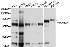 Western blot analysis of extracts of various cell lines, using MAN2A1 antibody. (alpha-Mannosidase II 抗体)