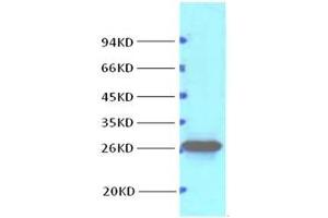 Western Blotting (WB) image for anti-B-Cell CLL/lymphoma 2 (BCL2) antibody (ABIN3181112)