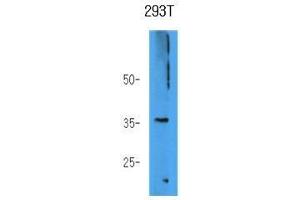 The 293T cell lysate (40 ug) were resolved by SDS-PAGE, transferred to PVDF membrane and probed with anti-human AKR7A3 antibody (1:1000). (AKR7A3 抗体)