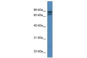 Western Blot showing KLHL22 antibody used at a concentration of 1-2 ug/ml to detect its target protein. (KLHL22 抗体  (N-Term))