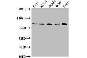 Western Blot Positive WB detected in: Hela whole cell lysate, MCF-7 whole cell lysate, HepG2 whole cell lysate, K562 whole cell lysate, Mouse heart tissue All lanes: OPA1 antibody at 1:2000 Secondary Goat polyclonal to rabbit IgG at 1/50000 dilution Predicted band size: 112, 116 kDa Observed band size: 112 kDa (OPA1 抗体  (AA 183-351))