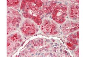 Human Kidney: Formalin-Fixed, Paraffin-Embedded (FFPE) (GGA1 抗体  (AA 1-89))