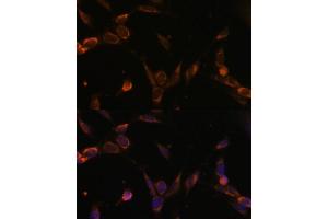 Immunofluorescence analysis of NIH-3T3 cells using USP30 Polyclonal Antibody (ABIN6131133, ABIN6150017, ABIN6150018 and ABIN6216645) at dilution of 1:100 (40x lens). (Usp30 抗体  (AA 57-390))