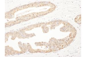 Immunohistochemistry (IHC) image for anti-Proteasome Subunit alpha 6 (PSMA6) (AA 196-246) antibody (ABIN7453443) (PSMA6 抗体  (AA 196-246))