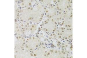 Immunohistochemistry of paraffin-embedded human stomach using PRPF3 Antibody.