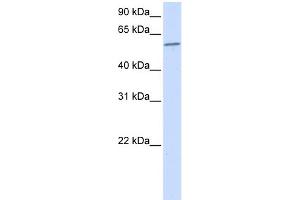 WB Suggested Anti-PPP3CA Antibody Titration:  0.
