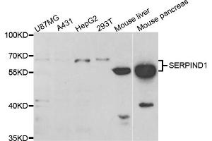 Western blot analysis of extracts of various cell lines, using SERPIND1 antibody (ABIN5973459) at 1/1000 dilution. (SERPIND1 抗体)