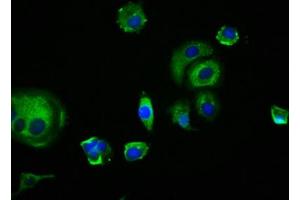Immunofluorescence staining of MCF-7 cells with ABIN7173899 at 1:166, counter-stained with DAPI. (EDAR 抗体  (AA 27-170))