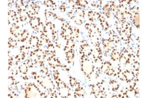 Formalin-fixed, paraffin-embedded human Thyroid stained with TTF-1 Mouse Monoclonal Antibody (8G7G3/1). (NKX2-1 抗体)