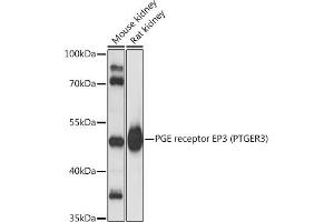 Western blot analysis of extracts of various cell lines, using PGE receptor EP3 (PTGER3) antibody (ABIN1682372, ABIN3018477, ABIN3018478 and ABIN6220477) at 1:3000 dilution. (PTGER3 抗体  (AA 1-53))