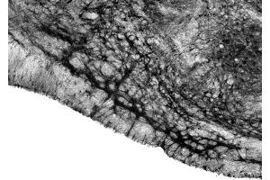 Adult rat trapezoid body immunohistochemistry.