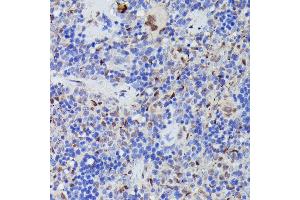 Immunohistochemistry of paraffin-embedded rat spleen using CDC23 antibody (ABIN7266248) at dilution of 1:100 (40x lens). (CDC23 抗体  (AA 50-150))