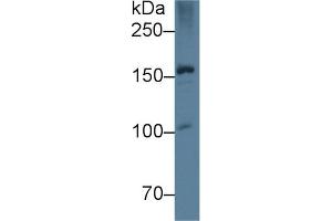 Detection of APOB in Rat Liver lysate using Monoclonal Antibody to Apolipoprotein B (APOB) (APOB 抗体  (AA 2747-2913))