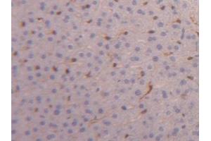 Detection of FABP4 in Mouse Liver Tissue using Polyclonal Antibody to Fatty Acid Binding Protein 4 (FABP4) (FABP4 抗体  (AA 2-132))