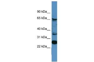 WB Suggested Anti-CANX  Antibody Titration: 0. (Calnexin 抗体  (C-Term))