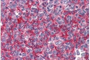 Human Tonsil: Formalin-Fixed, Paraffin-Embedded (FFPE) (GBP1 抗体  (AA 1-593))