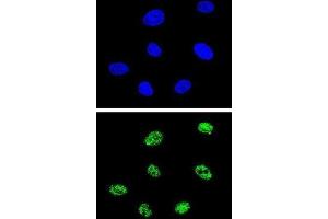 Immunofluorescence (IF) image for anti-Tumor Protein P73 (TP73) antibody (ABIN3003949) (Tumor Protein p73 抗体)