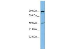 Image no. 1 for anti-Zinc Finger, MYND Domain Containing 12 (ZMYND12) (AA 35-84) antibody (ABIN6744891) (ZMYND12 抗体  (AA 35-84))