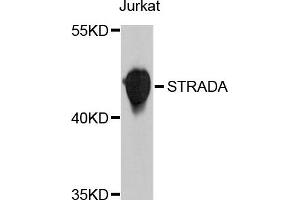Western blot analysis of extract of Jurkat cells, using STRADA antibody. (STRADA 抗体)