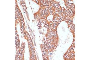 Immunohistochemistry (IHC) image for anti-Protein tyrosine Phosphatase, Receptor Type, N Polypeptide 2 (PTPRN2) (AA 22-242) antibody (ABIN7269710)